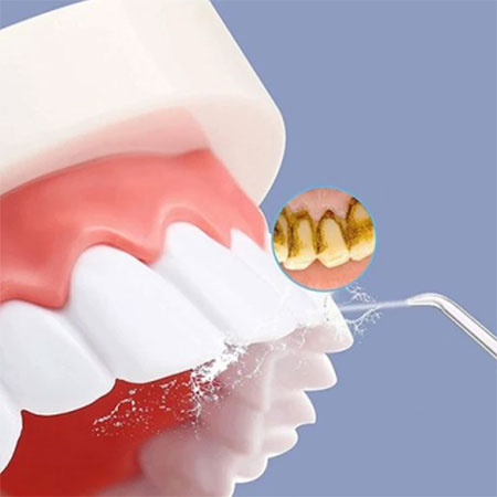 دستگاه شست و شوی دهان و دندان اچ تو اوفلس مدل HF-6